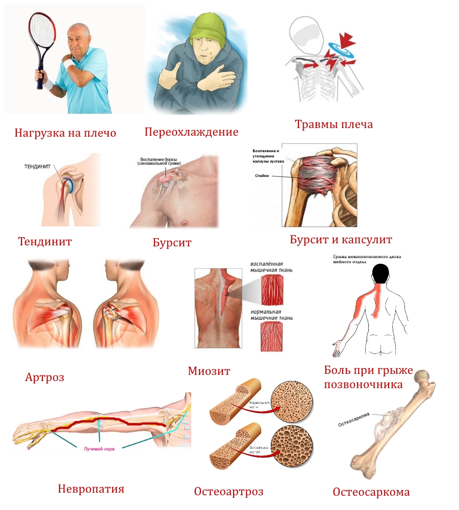 Причины болезненных ощущений