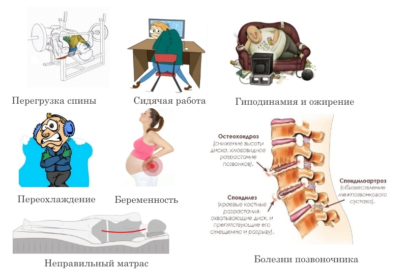 Причины защемления в спине