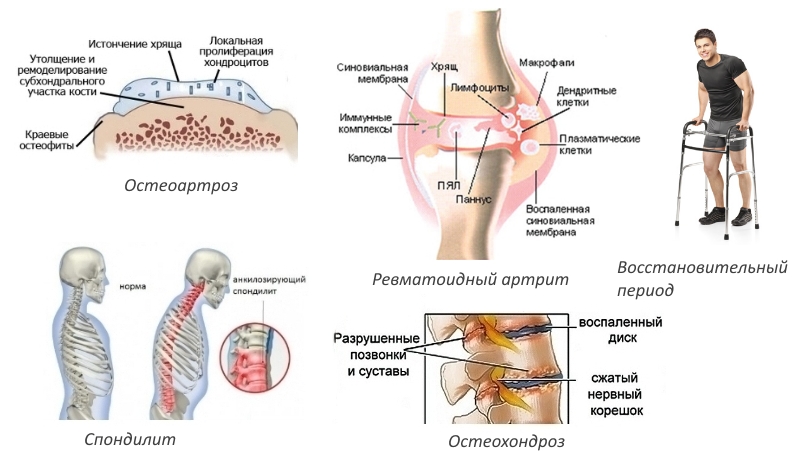 Показания к применению Мовасина