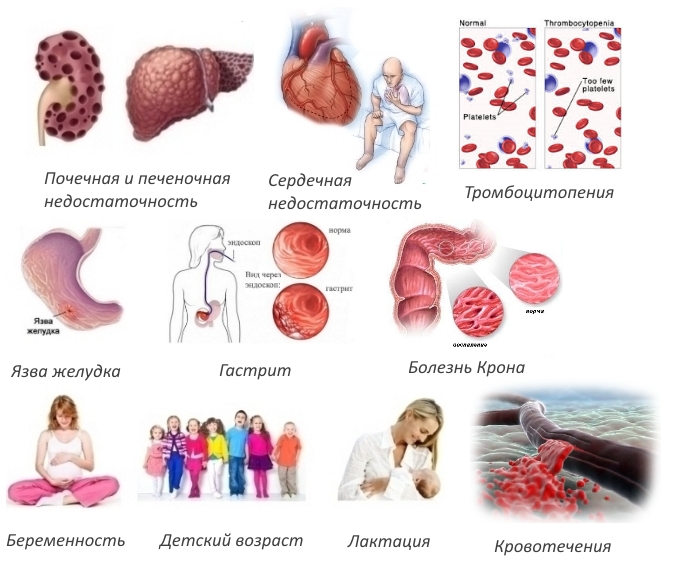 Противопоказания для Ксефокама
