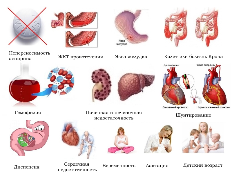 Противопоказания для Артрума
