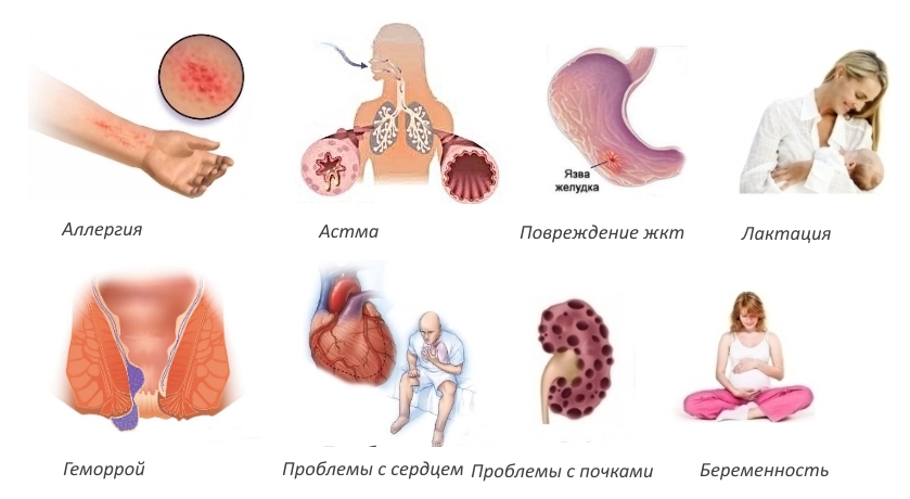 Противопоказания для Целебрекса