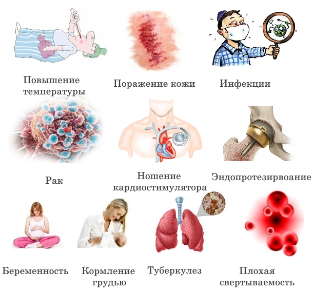 Противопоказания для физиолечения
