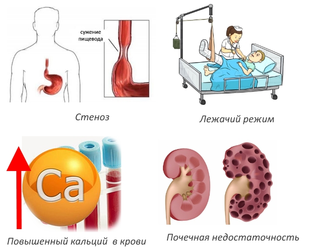 Противопоказания для Форозы