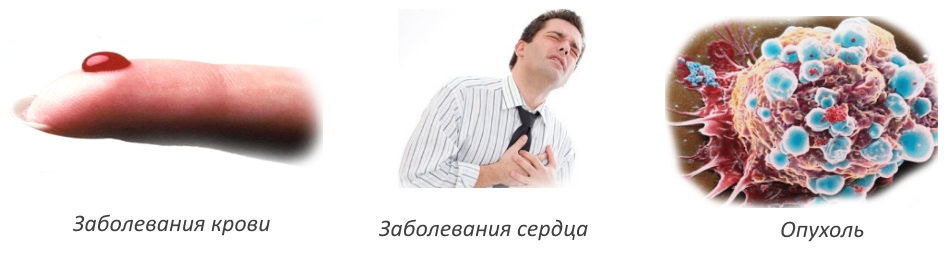 Противопоказания для гирудотерапии