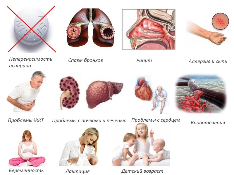 Противопоказания для инъекций Вольтарена