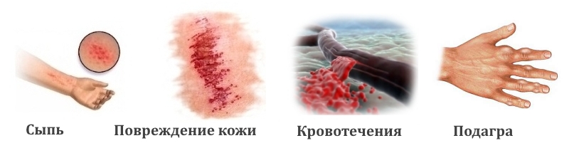 Противопоказания для ношения ортезов на палец