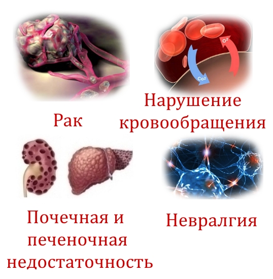 Противопоказания к Бишофиту