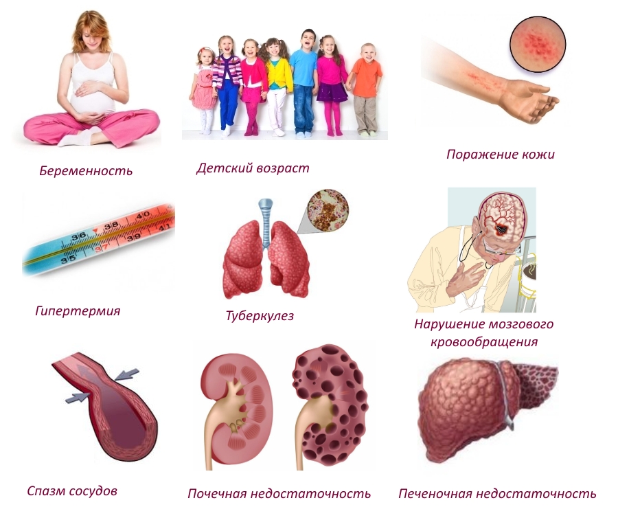 Противопоказания к использованию Салвисара