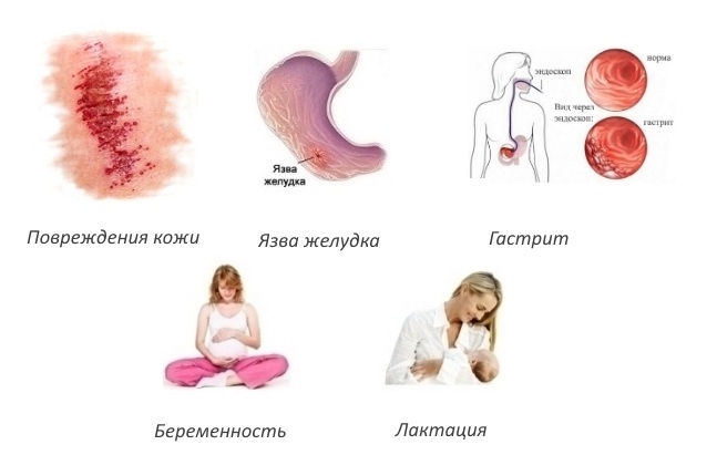 Противопоказания спрея Вольтарен