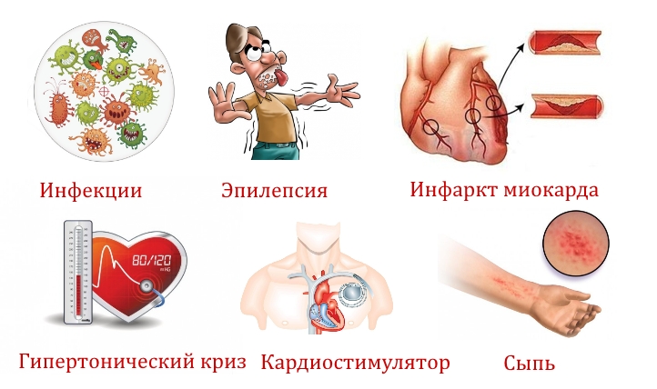 Противопоказания к электромиографии