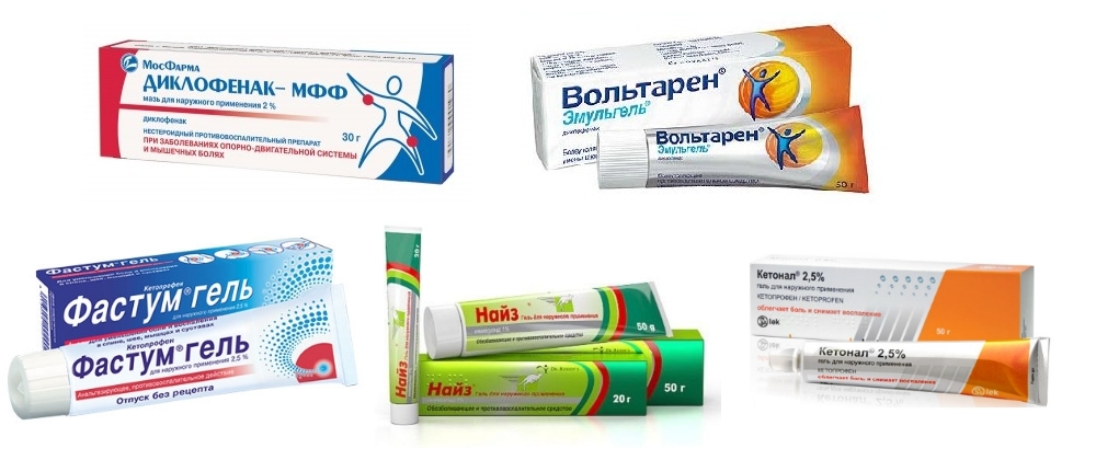 Противовоспалительные мази