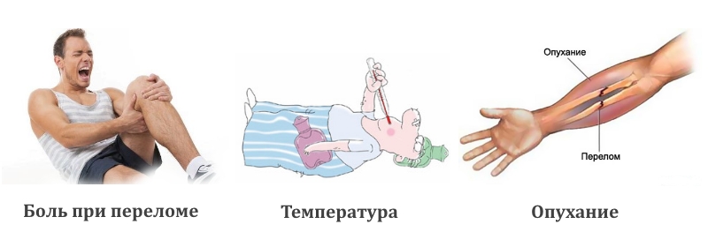 Симптомы при переломе