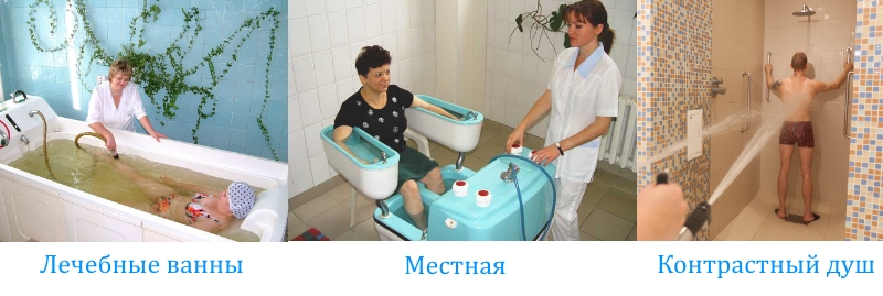 Основные типы бальнеотерапии