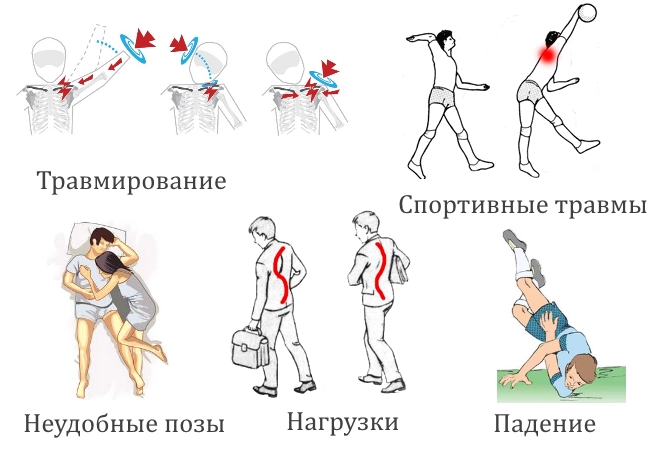 Травмы плеча