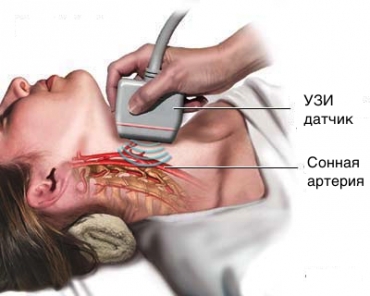 УЗИ шеи