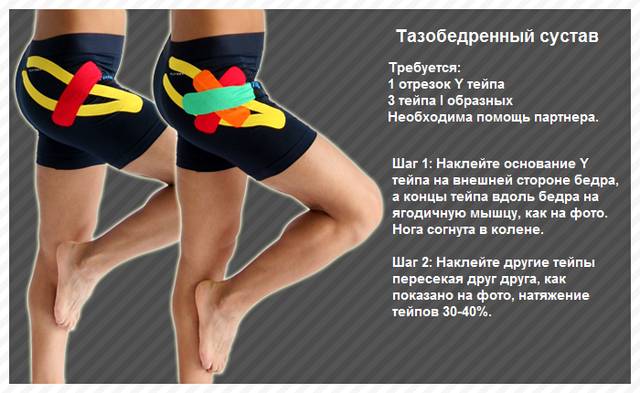 Варианты тейпирования тазобедренного сустава