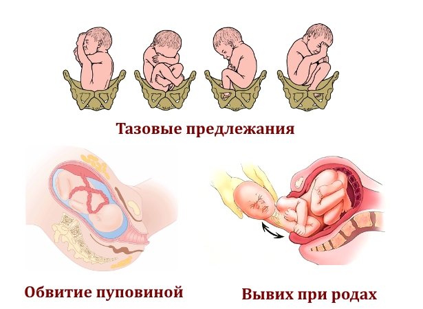 Врожденные причины подвывиха шеи