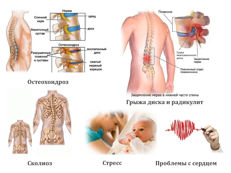 Возможные заболевания