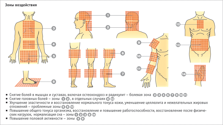 Зоны воздействия аппликатора Кузнецова