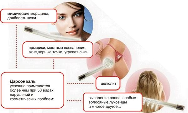 Применение Дарсонваля