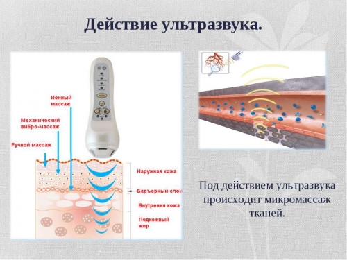Действие фонофереза