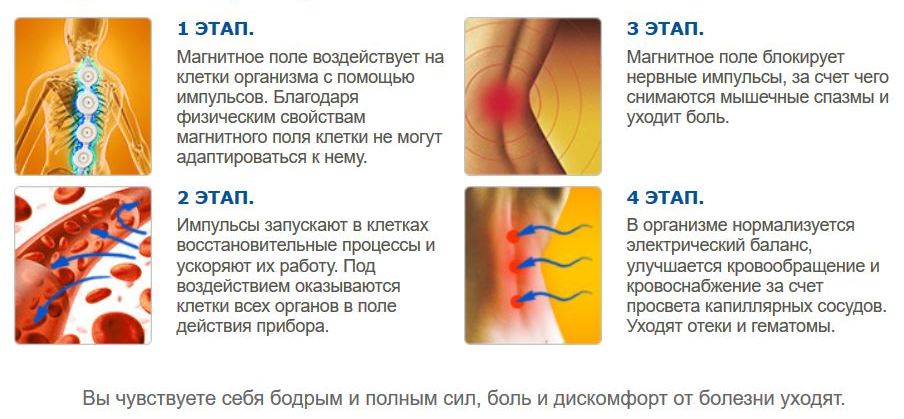 Действие аппарата Алмаг