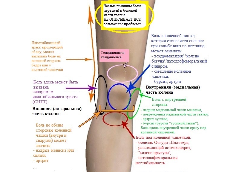 Диагностика колена по характеру боли