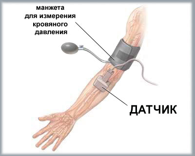 Допплерография сосудов рук