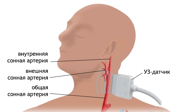 Дуплексное УЗИ сканирование