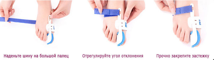 Инструкция по использованию фиксатора Hav Splint 