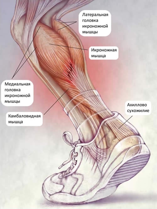 Икроножные мышцы