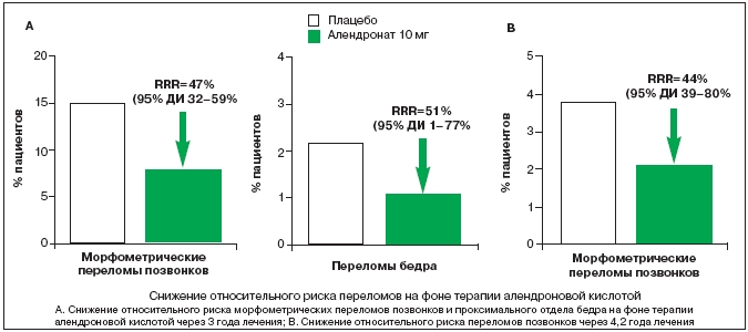 Исследование действия алендроновой кислоты