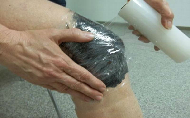 Компресс из глины на колено для снятия отёка