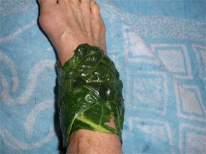 Компресс с лопухом при артрите