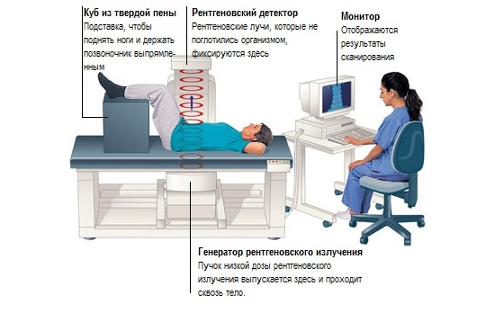 Костная денситометрия позвоночника