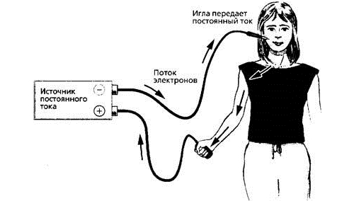 Лечение током шейного отдела позвоночника