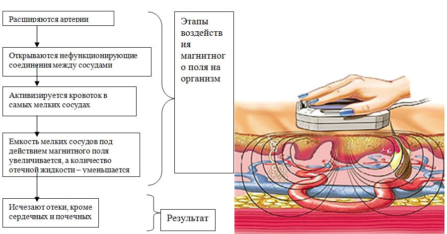 Функции магнитотерапии