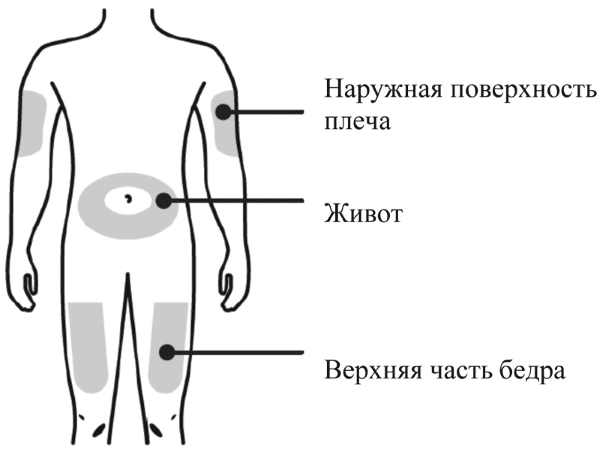Места для введения инъекций