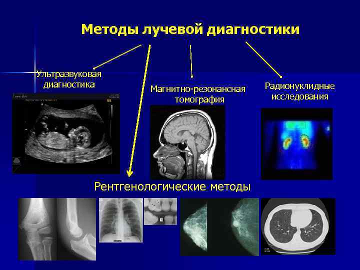 Методы лучевой диагностики
