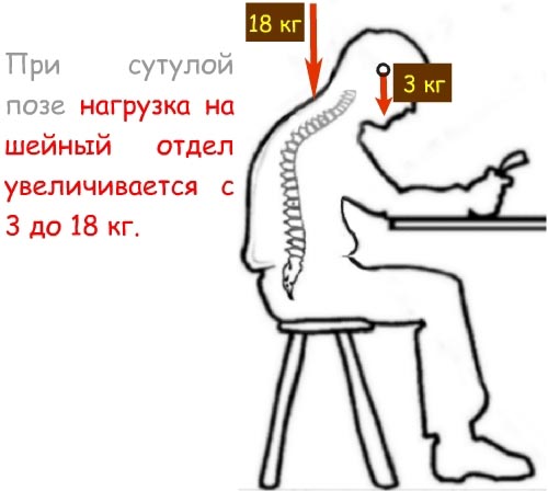 Нагрузка на шею при неправильной осанке