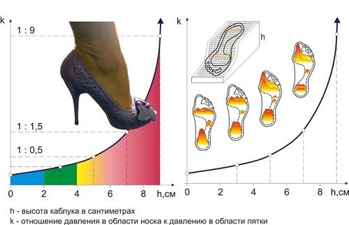Нагрузка на стопу при неудобной обуви