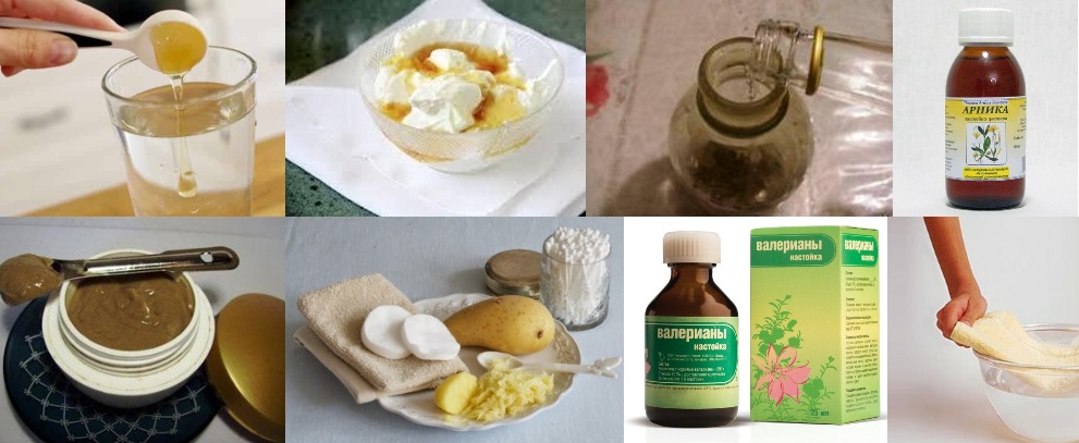 Народные средства для лечения копчика