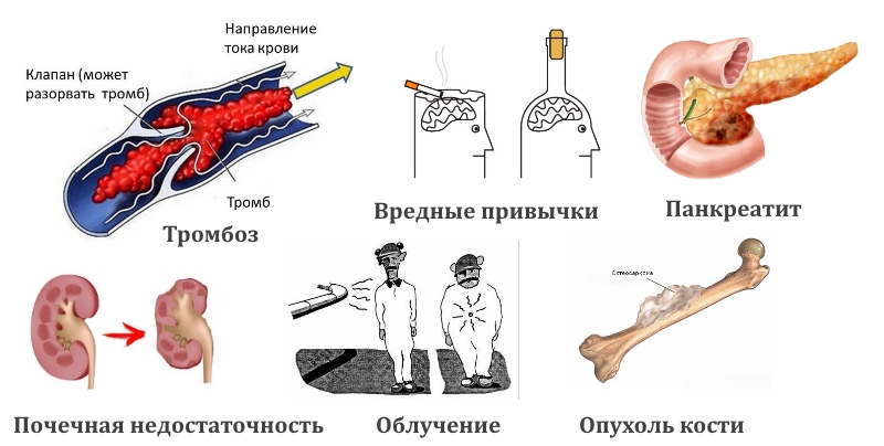 Нетравматические причины некроза
