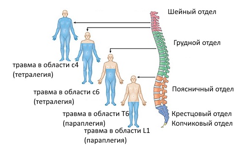 Онемение при поражении разных частей позвоночника