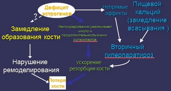 Остеопороз из-за дефицита эстрогенов