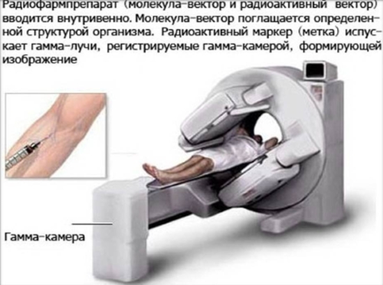 Описание сцинтиграфии