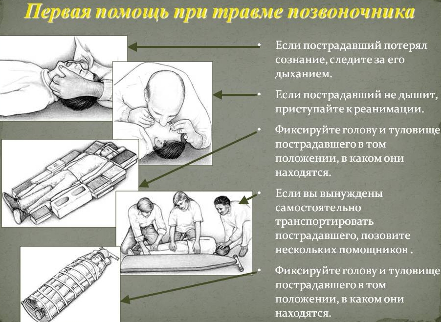 Первая помощь при переломе позвоночника