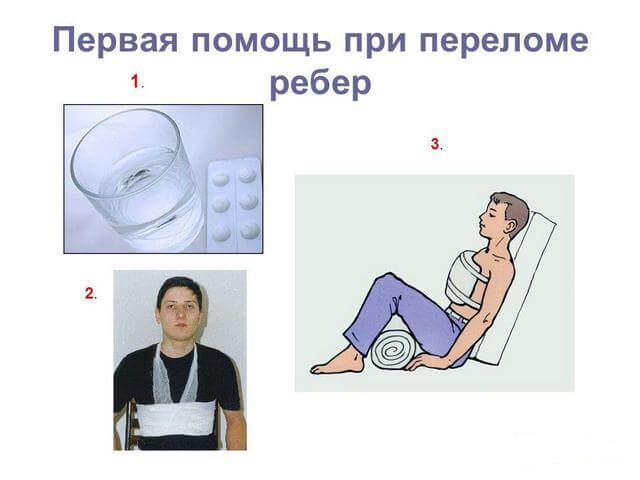 Первая помощь при реберных переломах