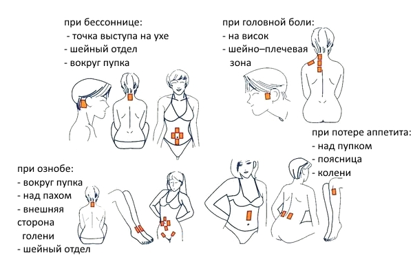 Показания для пластыря Salonpas